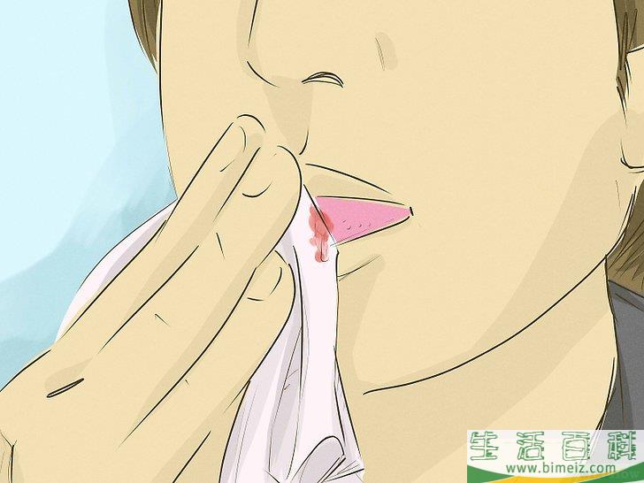 怎么治愈舌头上的伤口