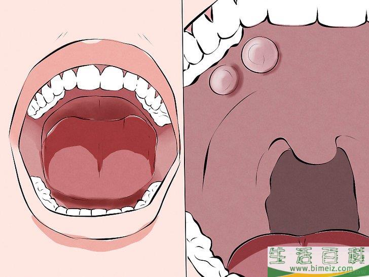 如何识别口腔癌的症状