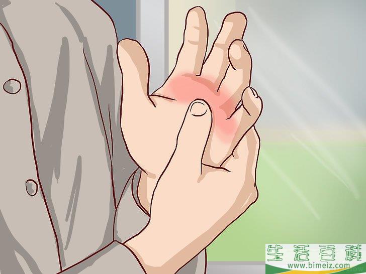 怎么知道自己的手指关节是否骨折