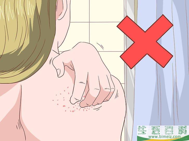怎么防治皮肤瘙痒